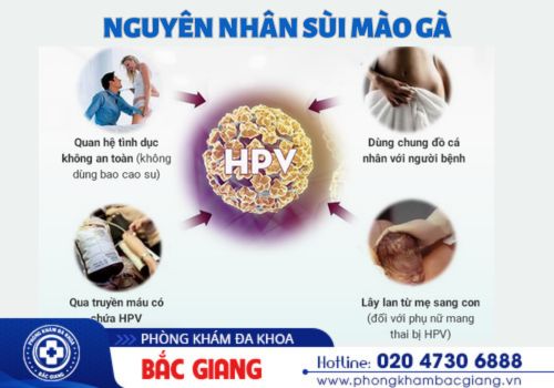 nguyên nhân sùi mào gà