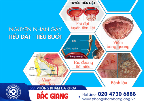 Nguyên nhân tiểu buốt - Hiểu để có biện phí xử lý đúng cách