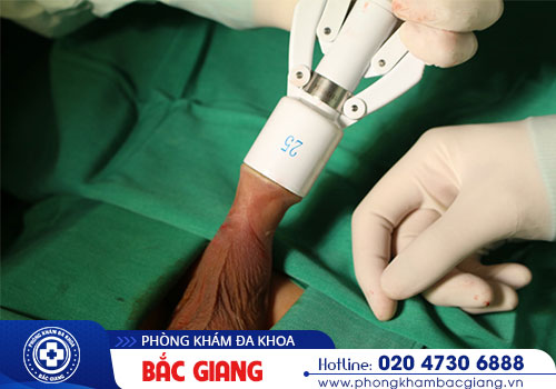 Nhận biết những biểu hiện dài bao quy đầu