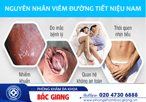 Viêm đường tiết niệu - Căn bệnh hoàn toàn có thể để lại nhiều biến chứng nghiêm trọng