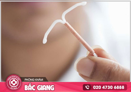 Nơi đặt vòng tránh thai tại Bắc Giang hiệu quả, an toàn