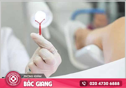Nơi đặt vòng tránh thai tại Bắc Giang hiệu quả, an toàn