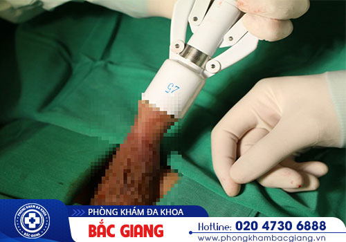 Phòng khám nam khoa chất lượng đáng tin cậy tại Bắc Giang