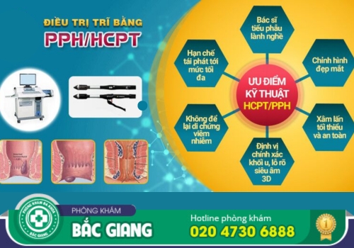 chi phí điều trị bệnh trĩ nội tại bắc giang