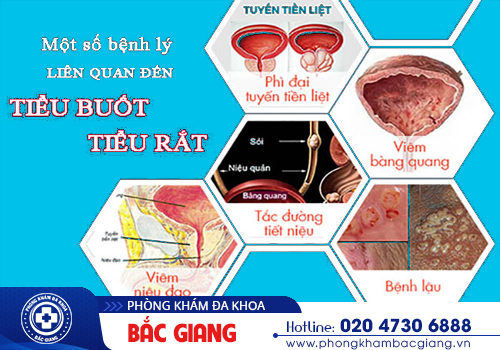 Phương pháp trị tiểu rát buốt giúp cải thiện chất lượng cuộc sống
