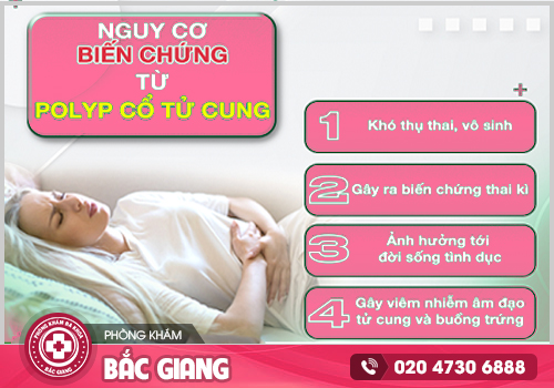 Polyp cổ tử cung - Chớ chủ quan!