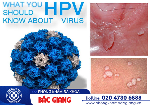 Nhận biết sùi mào gà âm đạo và hướng điều trị kịp thời nếu không may nhiễm bệnh