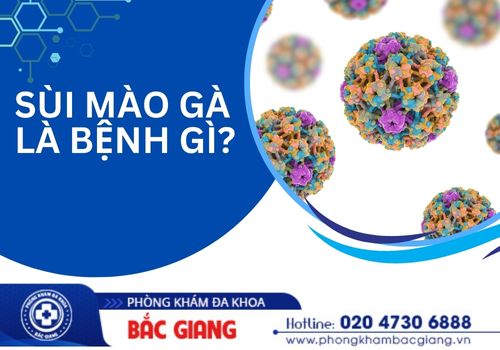 sùi mào gà là bệnh gì? nguy hiểm không?