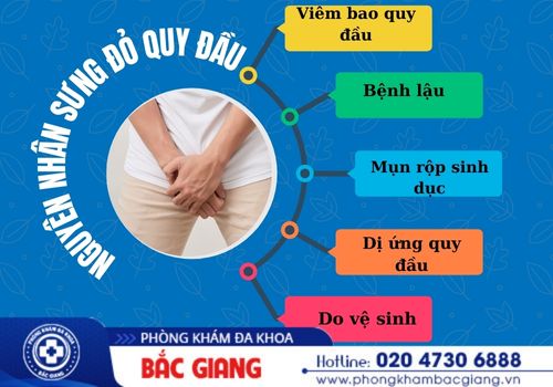 sưng đỏ quy đầu