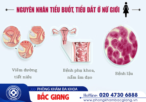 Tiểu buốt ở nam và nữ - Không đơn thuần như bạn nghĩ