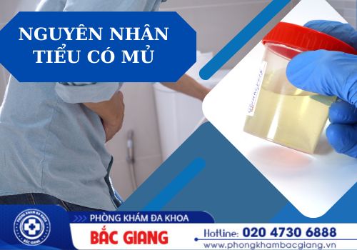 tiểu có mủ