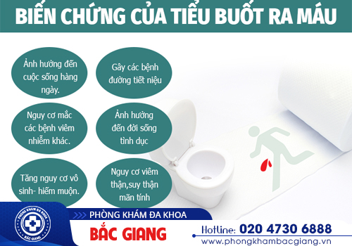 Tiểu buốt có máu là bị gì? Có nguy hiểm không?