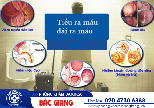 Tiểu buốt có máu là bị gì? Có nguy hiểm không?