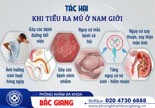 Tiểu ra mủ ở nam giới là bệnh gì? Có phải dấu hiệu của bệnh lậu?