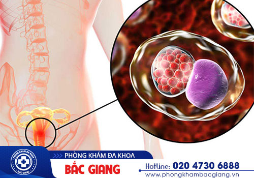 Tìm hiểu các giai đoạn bệnh lậu và triệu chứng cụ thể