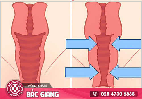 Tìm kiếm nơi chỉnh hình phụ khoa uy tín ở Bắc Giang