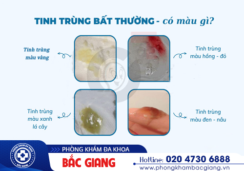Nhận biết tinh trùng bất thường và nỗi lo vô sinh ở nam giới