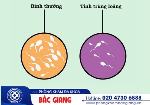 cách chữa tinh trùng loãng