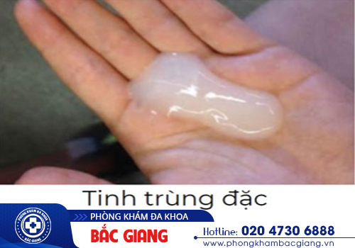 Tinh trùng màu trắng đục có phải bệnh lý?