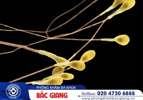 Tinh trùng màu vàng có bị vô sinh không?