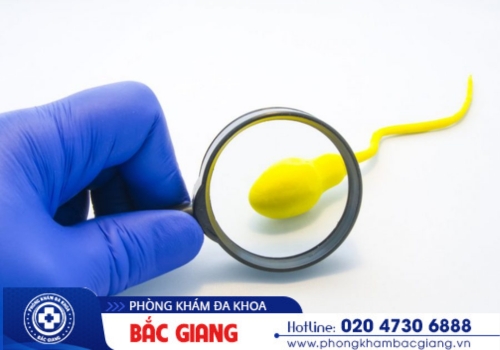 tinh trùng có màu vàng vón cục