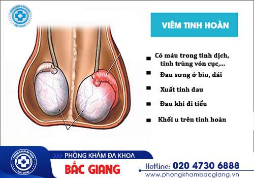 Tinh trùng vón cục như thạch nguy hiểm như thế nào? Cách khắc phục