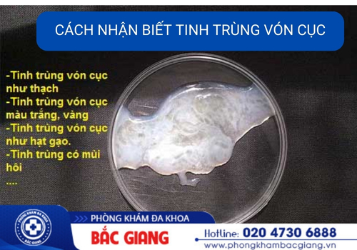 cách chữa tinh trùng bị vón cục