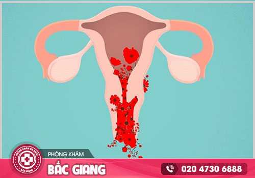 Tổng quan các thông tin cần biết về tình trạng rong kinh