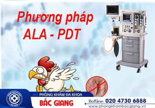 Tổng quan về bệnh sùi mào gà ở hậu môn