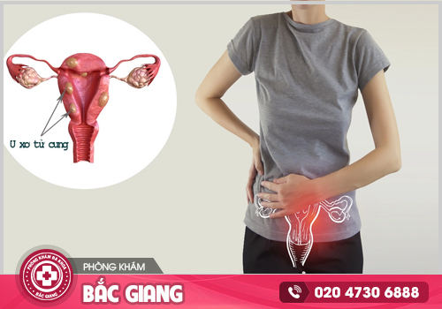 Bệnh phụ khoa cần kịp thời chữa trị