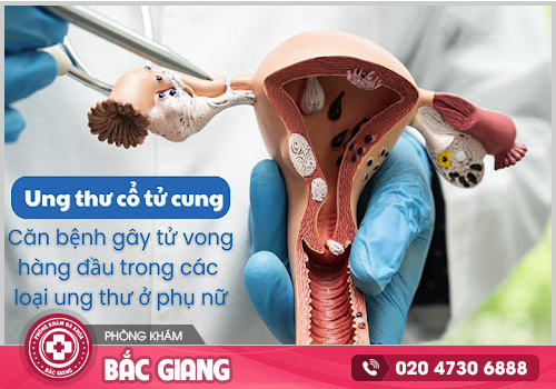 Bệnh phụ khoa cần kịp thời chữa trị