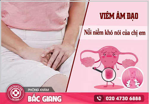 Viêm âm đạo - Căn bệnh phụ khoa nhiều chị em mắc phải
