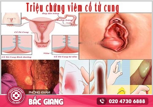 Bệnh phụ khoa cần kịp thời chữa trị