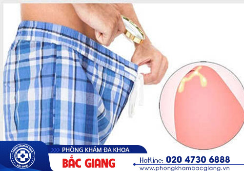 Viêm tiết niệu chảy mủ và những thông tin cần biết