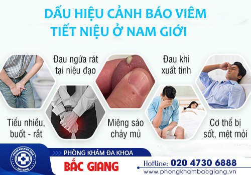 Viêm đường tiết niệu - Căn bệnh hoàn toàn có thể để lại nhiều biến chứng nghiêm trọng
