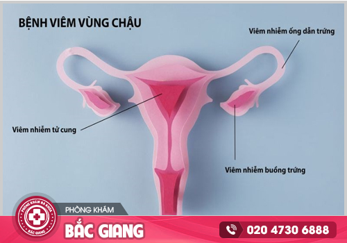 Bệnh phụ khoa cần kịp thời chữa trị