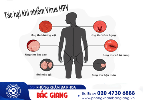 Virus HPV - Nguyên nhân gây ra nhiều bệnh lý ung thư nguy hiểm ở nam và nữ