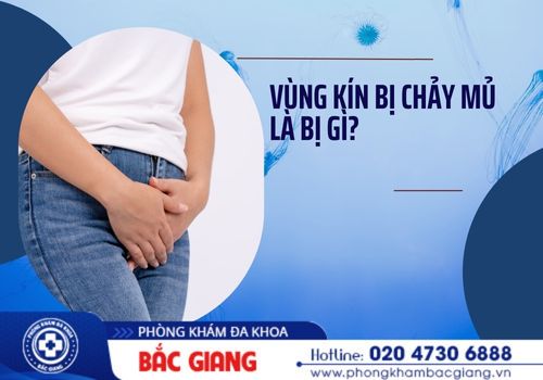 vùng kín bị chảy mủ là bị gì