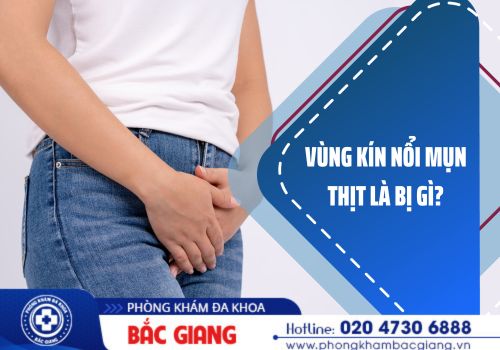 vùng kín nổi mụn thịt là bị gì?
