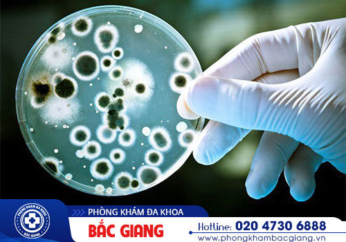 Xét nghiệm bệnh lậu gồm các xét nghiệm nào?