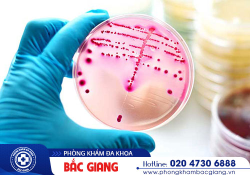 Xét nghiệm bệnh lậu ở đâu uy tín?