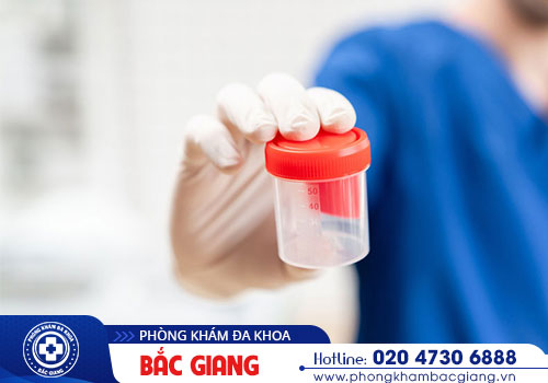 Xét nghiệm nam khoa gồm những xét nghiệm gì?