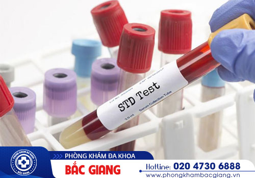 Xét nghiệm nhanh bệnh xã hội ở đâu uy tín?